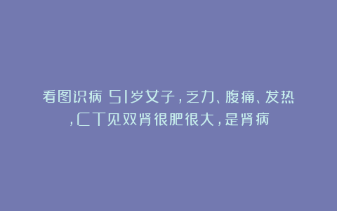 看图识病:51岁女子,乏力、腹痛、发热,CT见双肾很肥很大,是肾病?