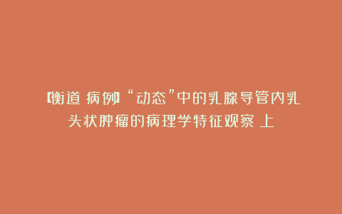 【衡道丨病例】“动态”中的乳腺导管内乳头状肿瘤的病理学特征观察(上)