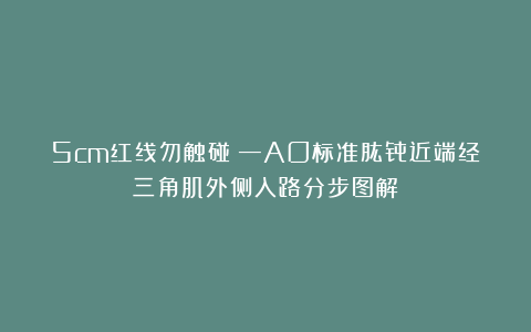 5cm红线勿触碰!—AO标准肱骨近端经三角肌外侧入路分步图解
