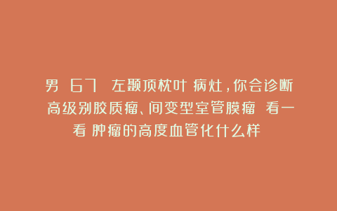 男 67 （左颞顶枕叶）病灶，你会诊断：高级别胶质瘤、间变型室管膜瘤？（看一看：肿瘤的高度血管化什么样？）