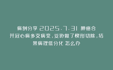 病例分享（2025.7.31）：肺癌合并冠心病多支病变，妥协做了楔形切除，结果病理低分化！怎么办？
