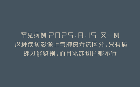 罕见病例（2025.8.15）：又一例！这种疾病影像上与肺癌无法区分，只有病理才能鉴别，而且冰冻切片都不行