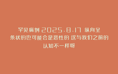 罕见病例（2025.8.17）：纵向呈条状的也可能会是恶性的！这与我们之前的认知不一样呀！