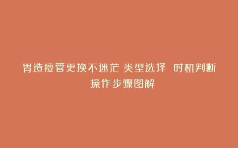 胃造瘘管更换不迷茫：类型选择 时机判断 操作步骤图解