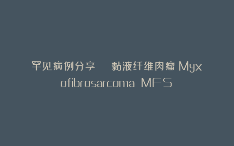 罕见病例分享 | 黏液纤维肉瘤（Myxofibrosarcoma MFS）