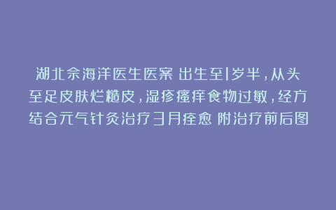 湖北佘海洋医生医案：出生至1岁半，从头至足皮肤烂糙皮，湿疹瘙痒食物过敏，经方结合元气针灸治疗3月痊愈（附治疗前后图）
