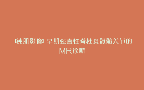 【骨肌影像】早期强直性脊柱炎骶髂关节的MR诊断