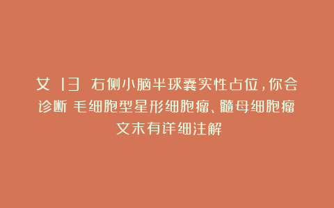 女 13 右侧小脑半球囊实性占位，你会诊断：毛细胞型星形细胞瘤、髓母细胞瘤？（文末有详细注解）