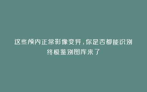 这些颅内正常影像变异，你是否都能识别？终极鉴别图库来了！
