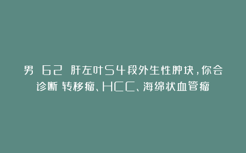 男 62 肝左叶S4段外生性肿块，你会诊断：转移瘤、HCC、海绵状血管瘤？