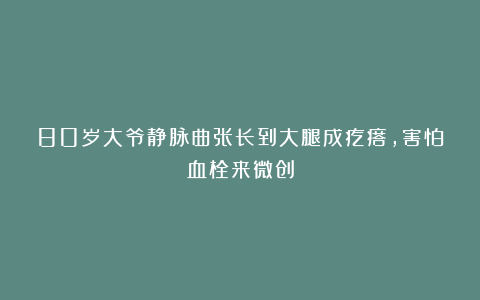80岁大爷静脉曲张长到大腿成疙瘩,害怕血栓来微创