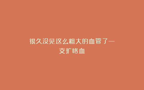 很久没见这么粗大的血管了—支扩咯血