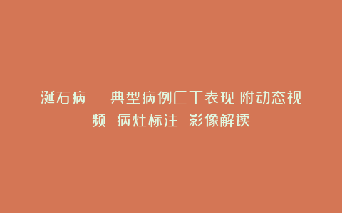 涎石病 | 典型病例CT表现(附动态视频 病灶标注 影像解读)