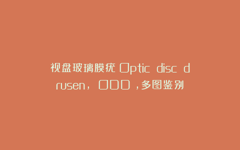 视盘玻璃膜疣(Optic disc drusen, ODD),多图鉴别